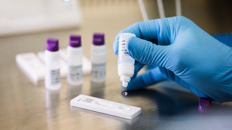 Point of Care Rapid Antigen Testing Solutions: Fast, Reliable, and Convenient Diagnostics